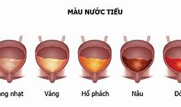 Tại Sao Nước Tiểu Có Màu Trong Suốt